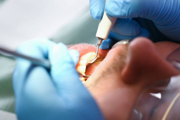 Best Orthodontic Emergency Dentist in Beverly, OH