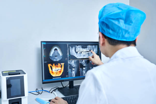 Best Emergency Dentist for Lost Fillings or Crowns in Beverly, OH